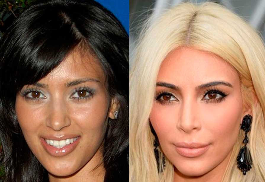 Kim Kardashian Before And After Plastic Surgery Kim Kardashian Before And After Plastic Surgery